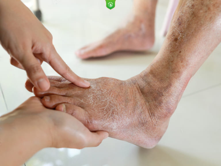 Tầm quan trọng của việc chăm sóc bàn chân người bệnh tiểu đường.